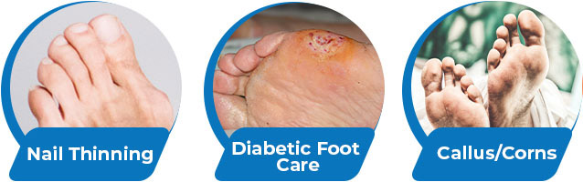 Diabetic Foot Care